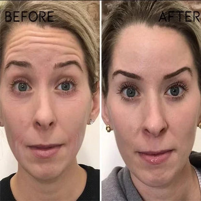 🔥Last Day Promotion 70% OFF🔥-Botox Face Serum
